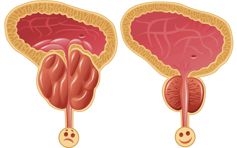причини виникнення проблем із потенцією у чоловіків